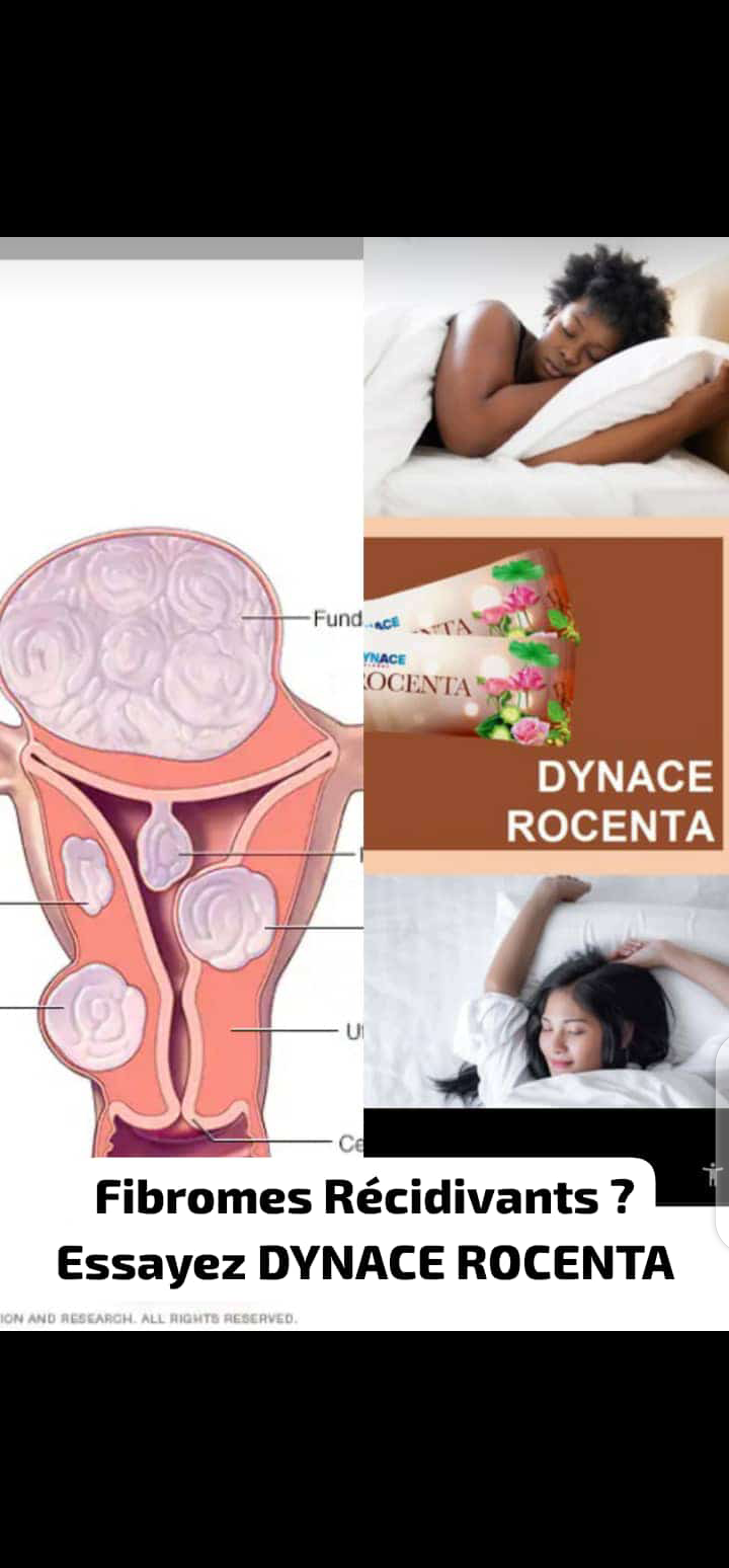 DYNACE ROCENTA